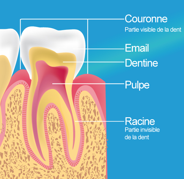 devitalisation dentaire Ensuès La Redonne